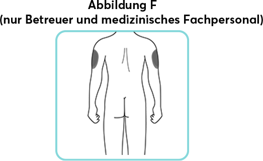 Updated_Abbildung F