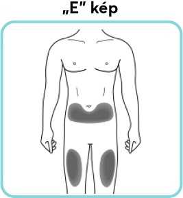 „E”-kép.jpg 