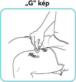 „G”-kép.jpg