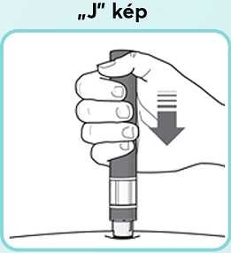 „J”-kép.jpg