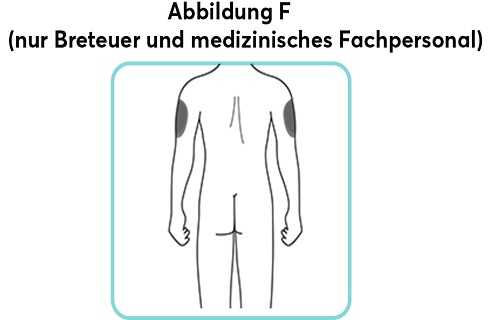 Abbildung-F_new