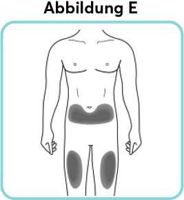 Abbildung-E_new