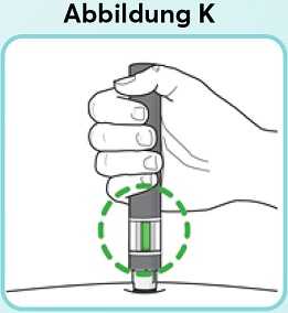 Abbildung-K_new